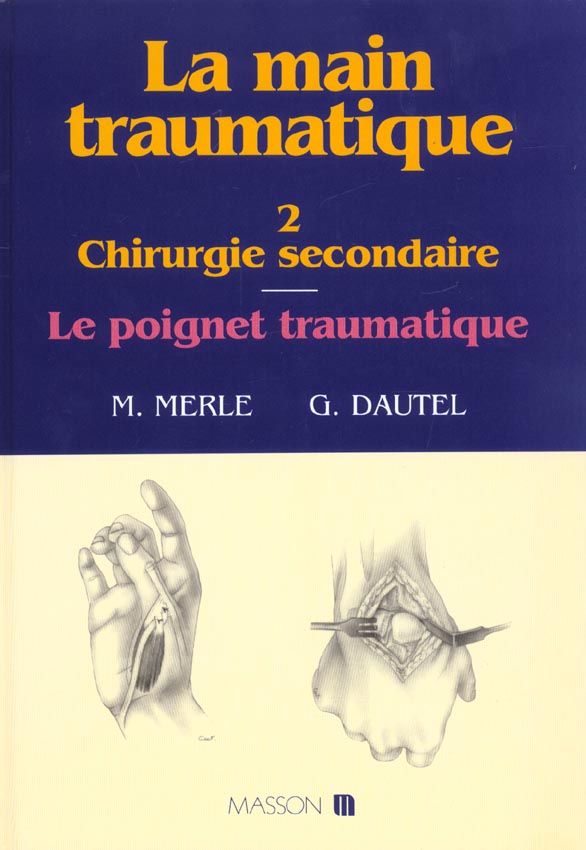 La main traumatique. Tome 2