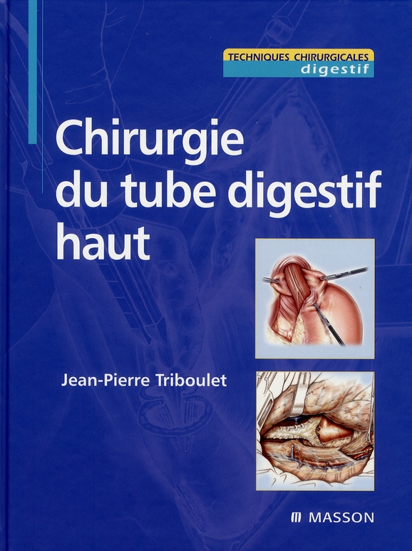 Chirurgie du tube digestif haut