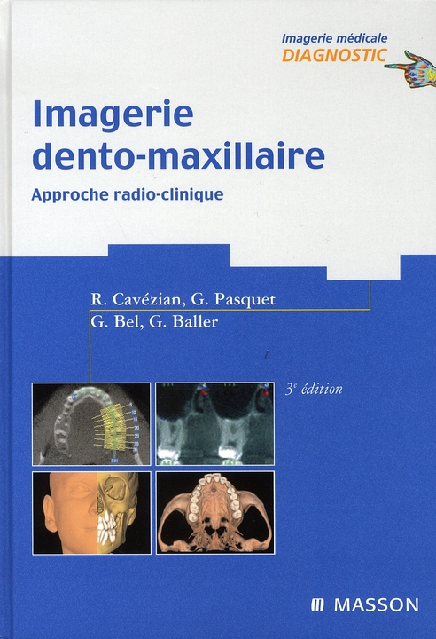 Imagerie dento-maxillaire. Approche radio-clinique, 3e édition