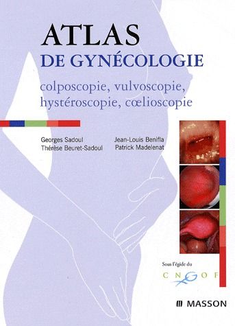 Atlas de gynécologie. Colposcopie, vulvoscopie, hystéroscopie, coelioscopie