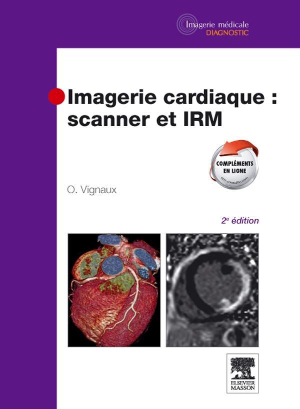 Imagerie cardiaque : scanner et IRM. 2e édition