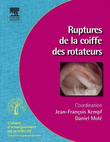 Ruptures de la coiffe des rotateurs
