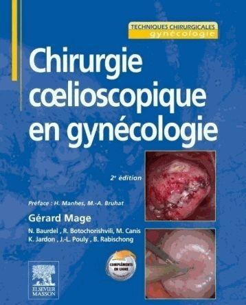 Chirurgie coelioscopique en gynécologie. 2e édition