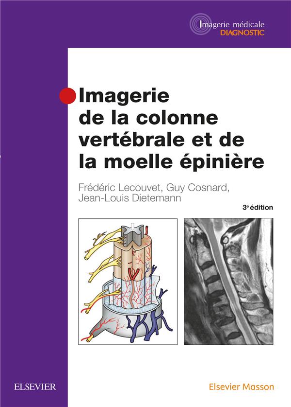 Imagerie de la colonne vertébrale et de la moelle épinière. 3e édition