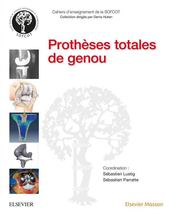 Prothèses totales de genou