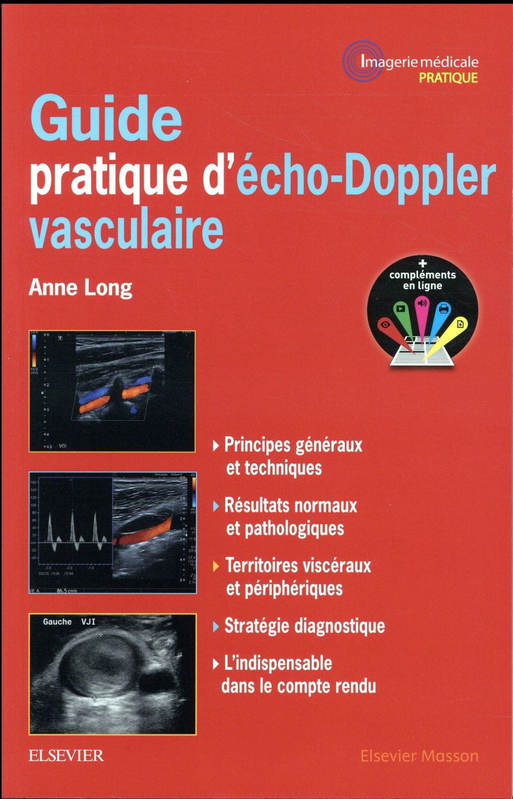 Guide pratique d'écho-Doppler vasculaire