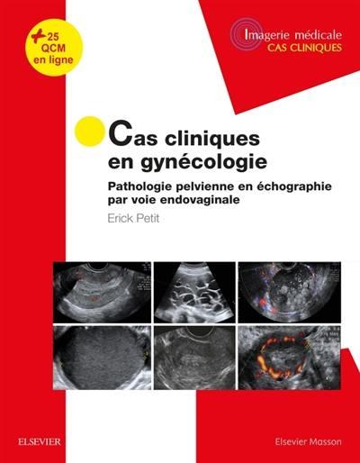 Cas cliniques en gynécologie. Pathologie pelvienne en échographie par voie endovaginale