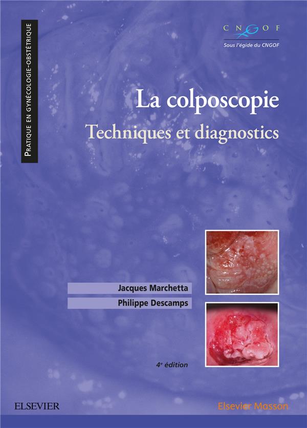 La colposcopie. Techniques et diagnostics, 4e édition