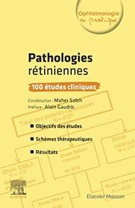 Pathologies rétiniennes. 100 études cliniques