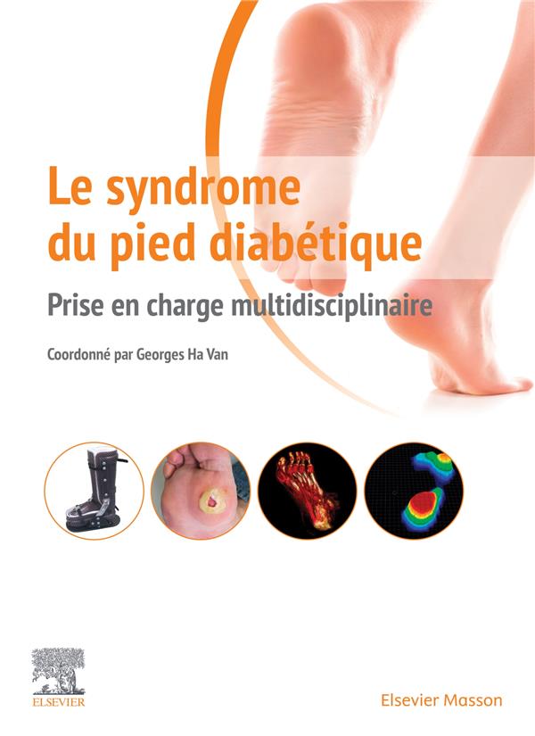 Le syndrome du pied diabétique. Prise en charge multidisciplinaire