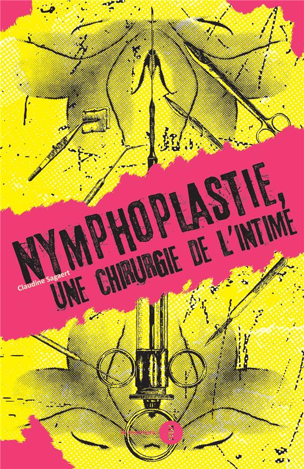 La Nymphoplastie. Une chirurgie de l'intime