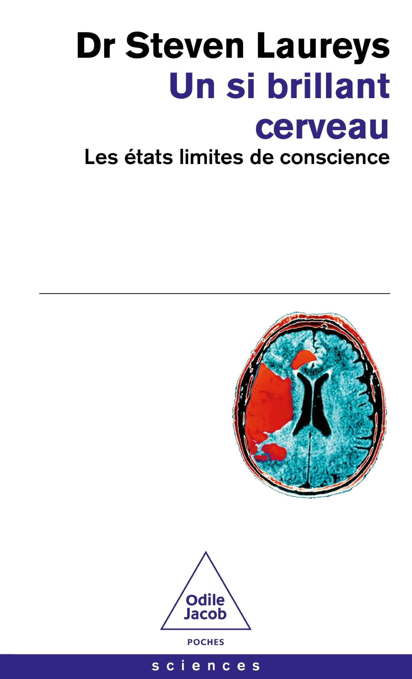 Un si brillant cerveau. Les états limites de conscience