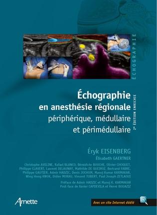 Echographie en anesthésie régionale périphérique, médullaire et périmédullaire. 2e édition