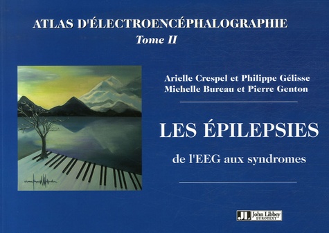 Atlas d'électroencéphalographie. Tome 2, Les épilepsies, de l'EEG aux syndromes