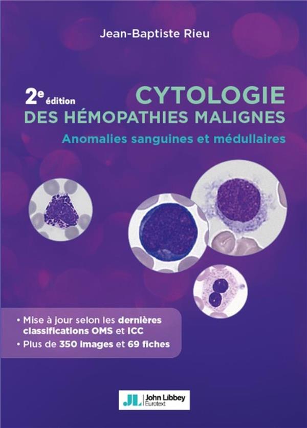Cytologie des hémopathies malignes. Anomalies sanguines et médullaires