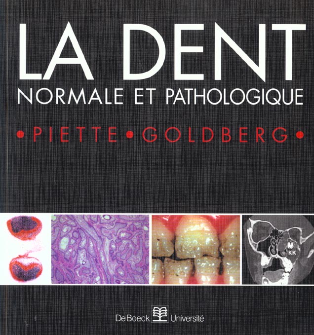 La dent normale et pathologique