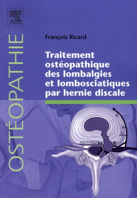 Traitement ostéopathique des lombalgies et lombosciatiques par hernie discale