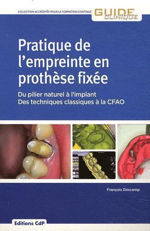 Pratique de l'empreinte en prothèse fixée. Du pilier naturel à l'implant, des techniques classiques