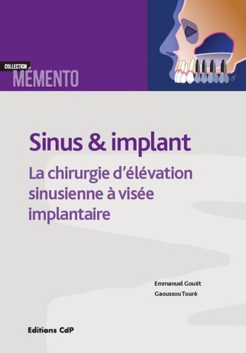 Sinus & implant. Chirurgie d'élévation sinusienne à visée implantaire