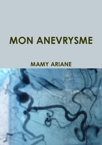 Mon anevrysme