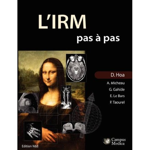 L'IRM Pas a Pas (Edition Noir & Blanc)