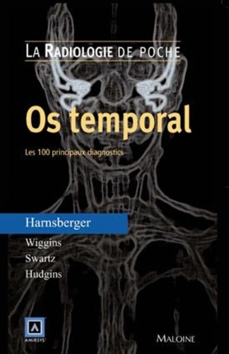 Os temporal. Les 100 principaux diagnostics