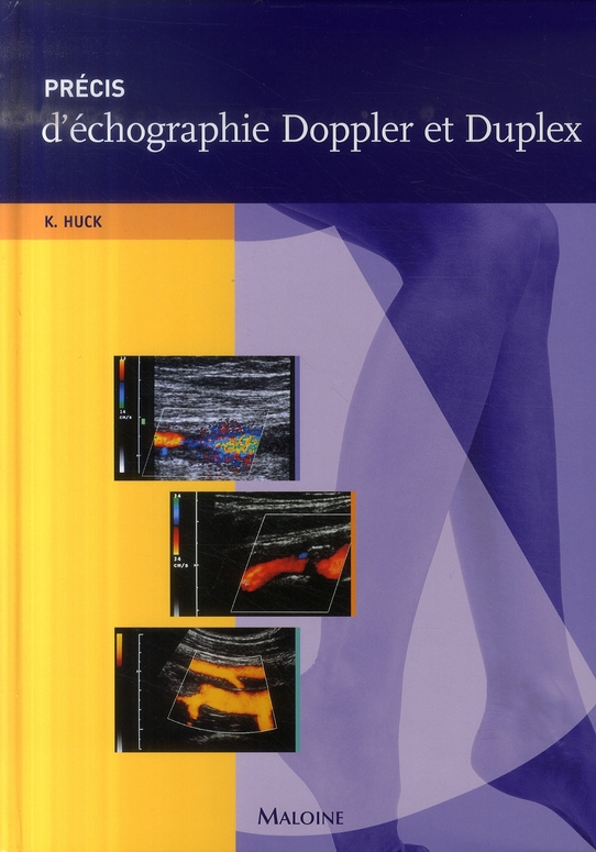 Précis d'échographie Doppler et Duplex