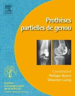 Prothèses partielles du genou