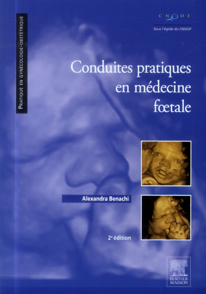 Conduites pratiques en médecine foetale. 2e édition
