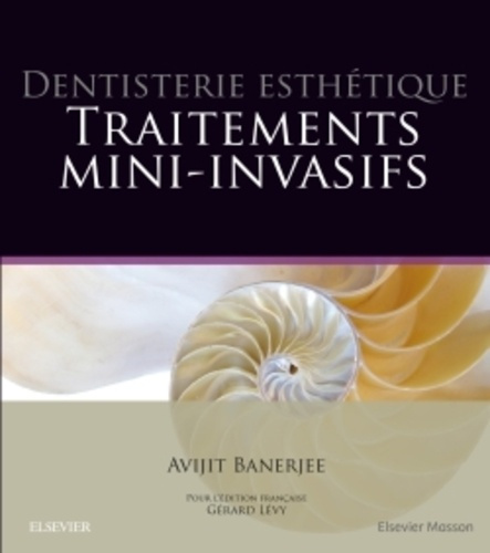 Dentisterie esthétique. Traitements mini-invasifs