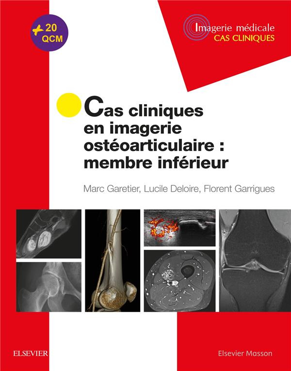 Cas cliniques en imagerie ostéoarticulaire. Membre inférieur