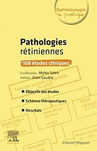 Pathologies rétiniennes. 100 études cliniques