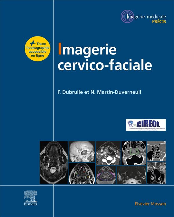 Imagerie cervico-faciale. Massif facial - Sinus - Voies aérodigestives supérieures - Pathologies cer