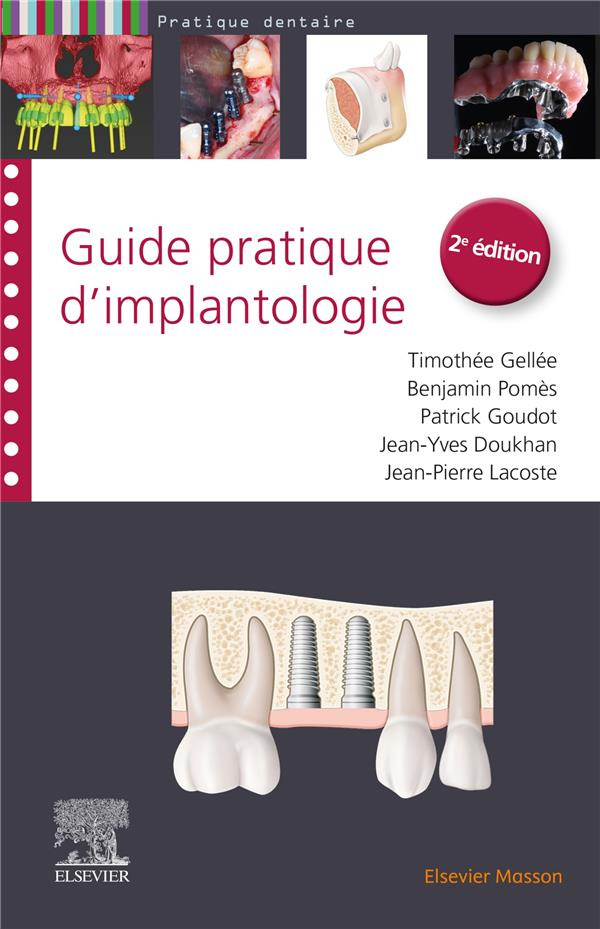 Guide pratique d'implantologie. 2e édition