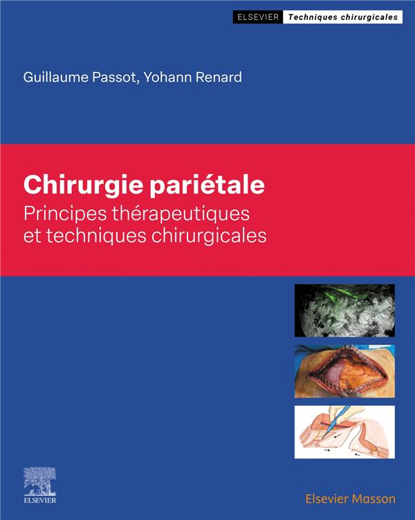 Chirurgie pariétale. Principes thérapeutiques et techniques chirurgicales