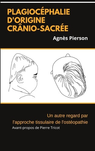 Plagiocéphalie d'origine crânio-sacrée. Un autre regard par l'approche tissulaire de l'ostéopathie