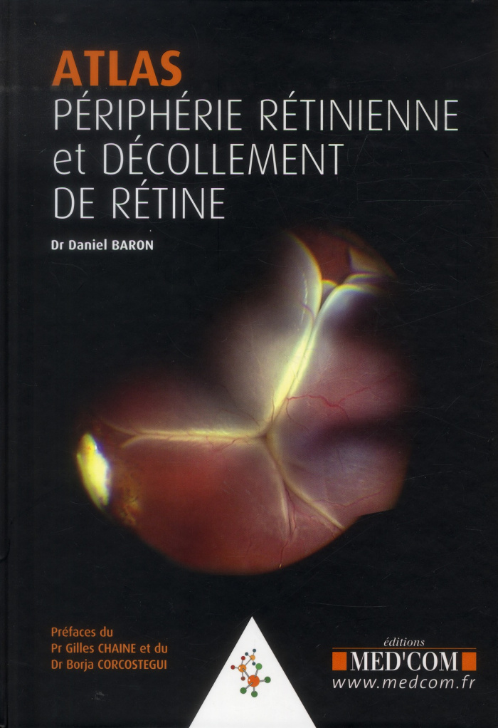 Atlas Périphérie rétinienne et décollement de rétine