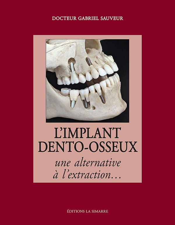 L'implant dento-osseux. Une alternative à l'extraction...