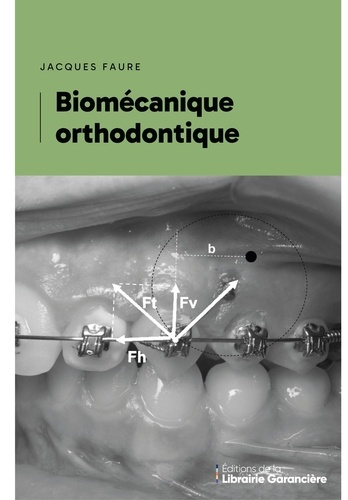 Biomecanique orthodontique