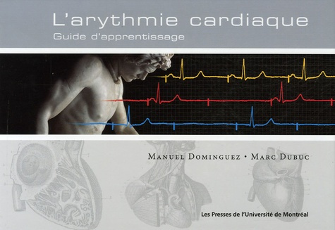 Arythmie cardiaque. Guide d'apprentissage