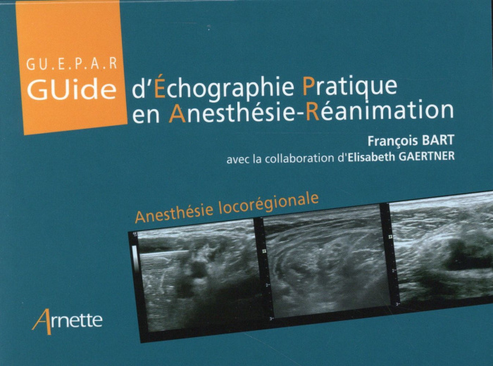 Guide d'Echographie Pratique en Anesthésie-Réanimation. Anesthésie Iocorégionale