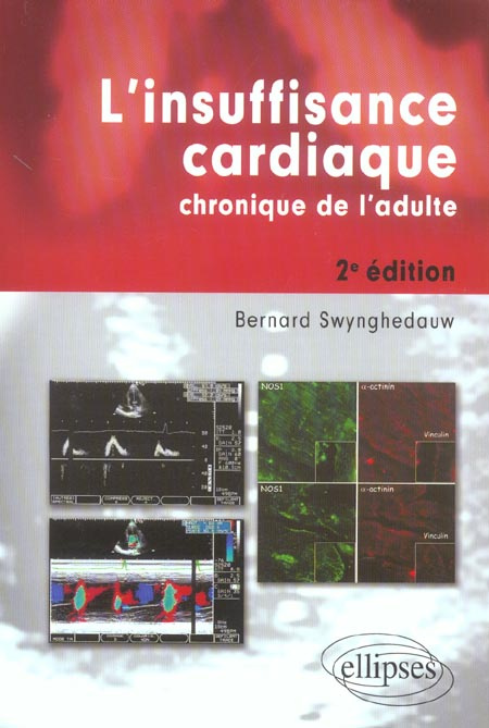 L'insuffisance cardiaque chronique de l'adulte. 2e édition