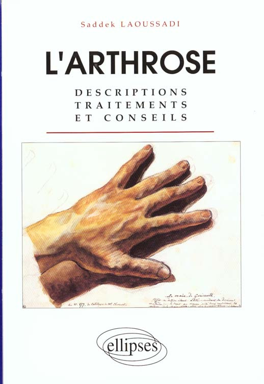 L'ARTHROSE. Descriptions, traitements et conseils