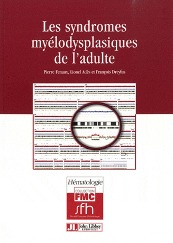 LES SYNDROMES MYELODYSPLASIQUES DE L'ADULTE