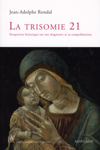 La trisomie 21. Perspective historique sur son diagnostic et sa compréhension