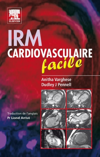 IRM cardiovasculaire facile