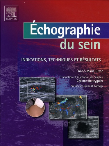 Echographie du sein. Indications, techniques et résultats