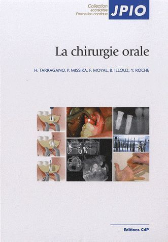 La chirurgie orale