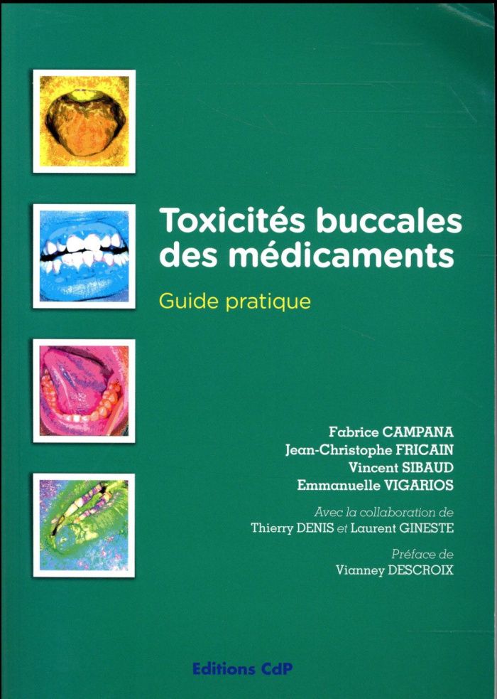 Toxicités buccales et effets indésirables des médicaments