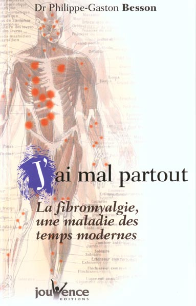 J'ai mal partout. La fibromyalgie, une maladie des temps modernes